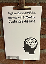 ISBN: 9789039363089 - Title: High resolution MRI in patients with stroke or Cushing's disease